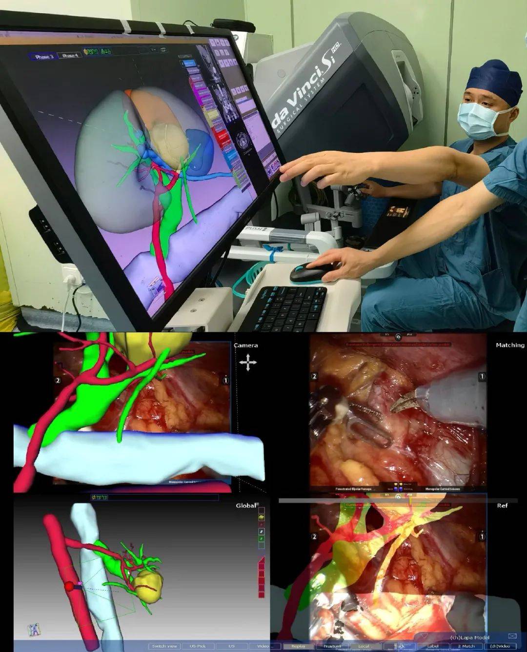 热烈祝贺！医院泌尿外科吴震杰教授喜获第二十届“银蛇奖”