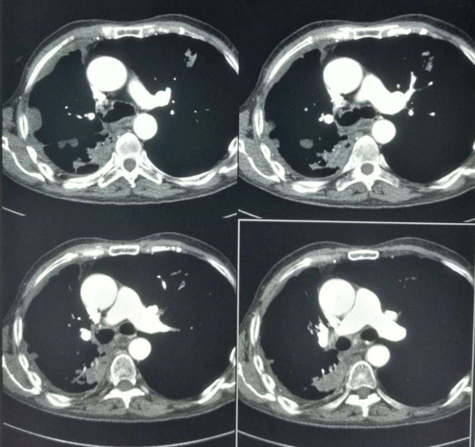 xrp转移(xrp币今日行情)