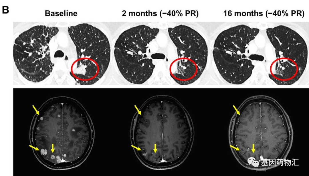 xrp转移(xrp瑞波币最新消息) xrp转移(xrp瑞波币最新消息)